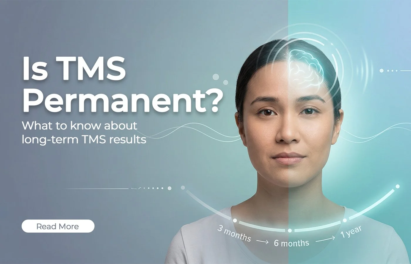 Is TMS Permanent? What You Need to Know About Long-Term TMS Results