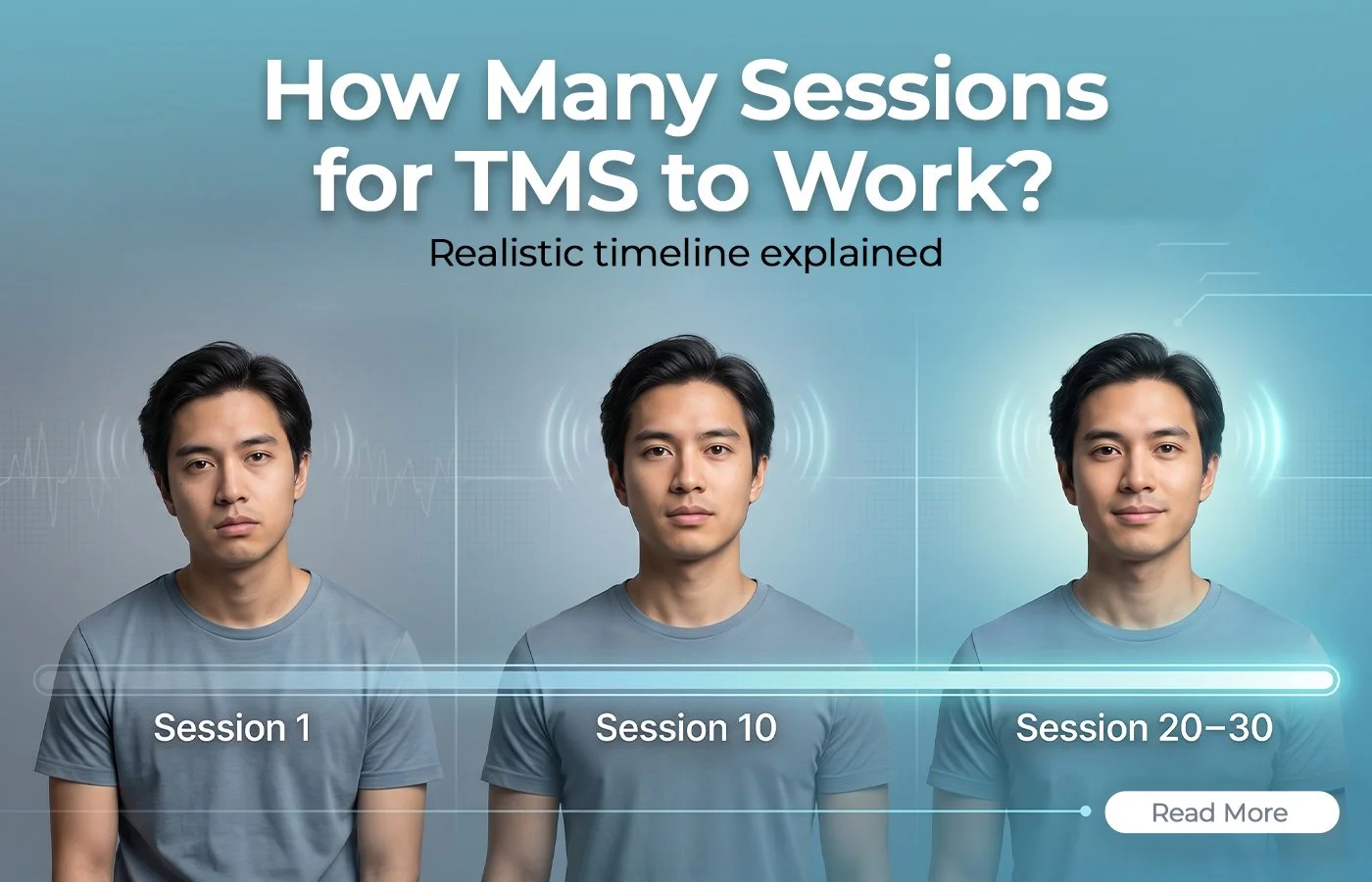 How Many Sessions for TMS to Work? Realistic Timeline Explained