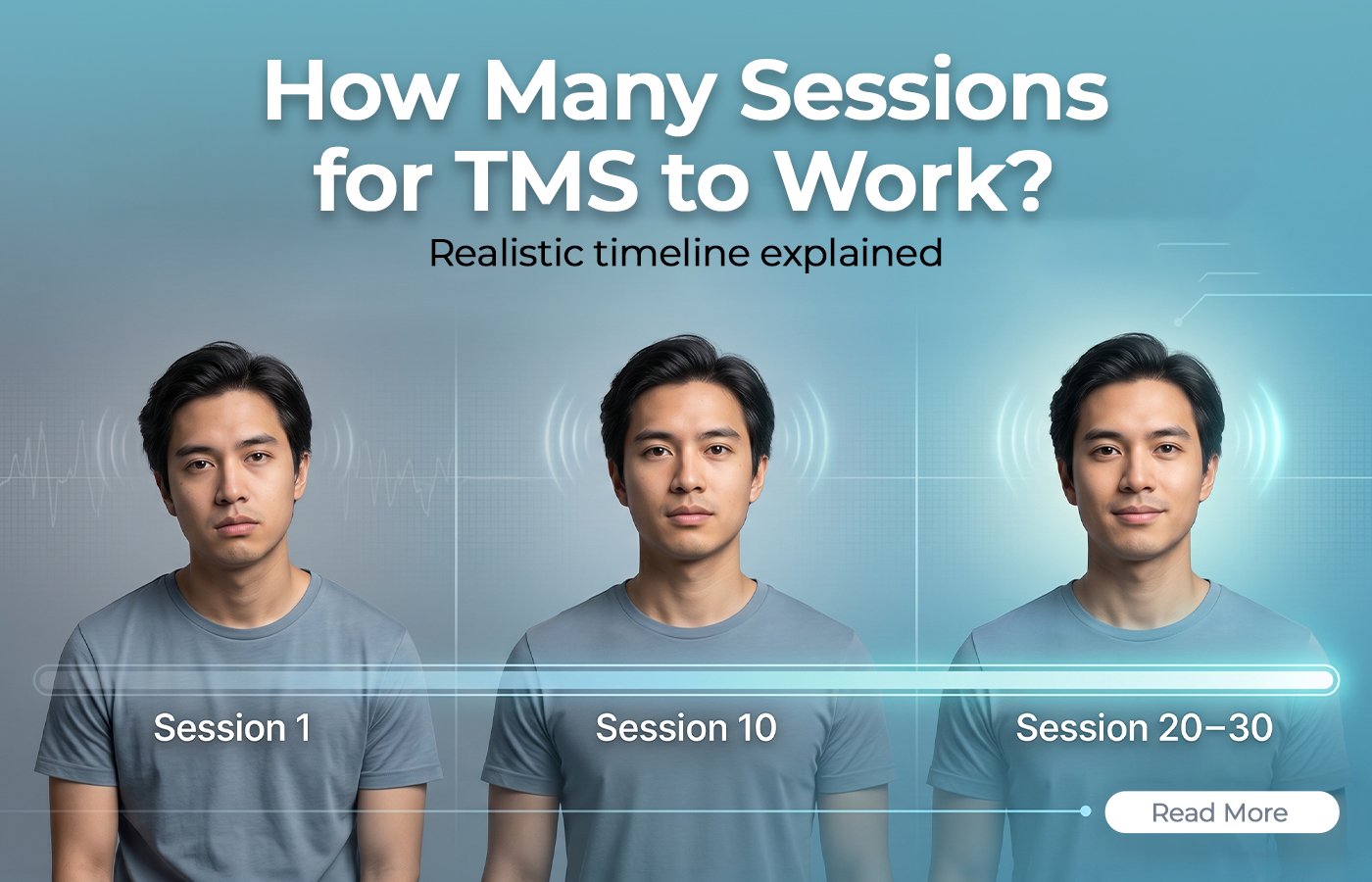 How Many Sessions for TMS to Work?