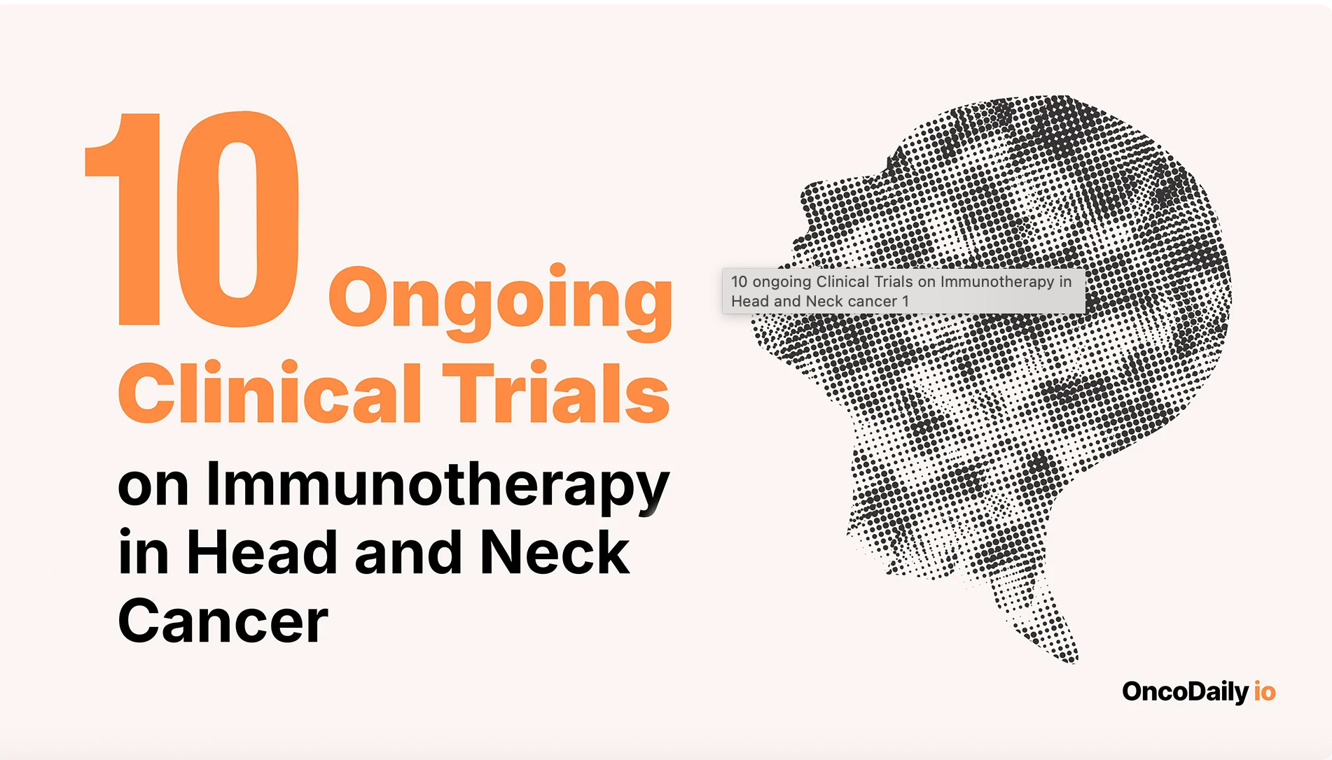 10 ongoing Clinical Trials on Immunotherapy in Head and Neck cancer