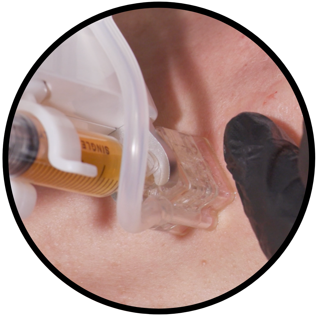 Hycomin Injectable Nobamedi HYCOOX Injector | Multi Injector with AI | Auto Injector ...