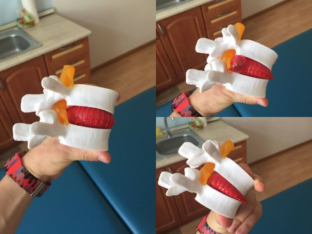 ČO SÚ TO TIE MEDZISTAVCOVÉ PLATNIČKY ?