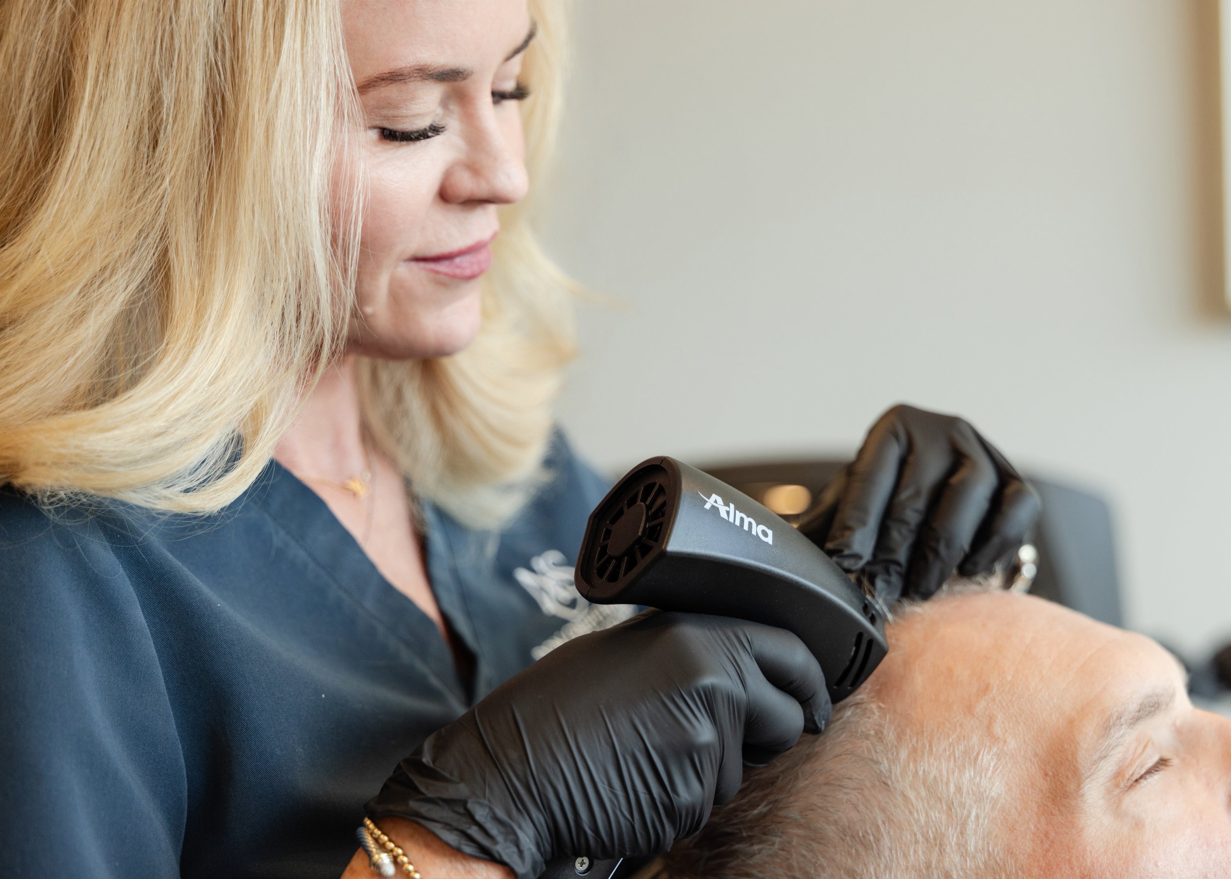 Esthetician in black gloves using an Alma laser device on a patient's scalp during a hair restoration treatment.