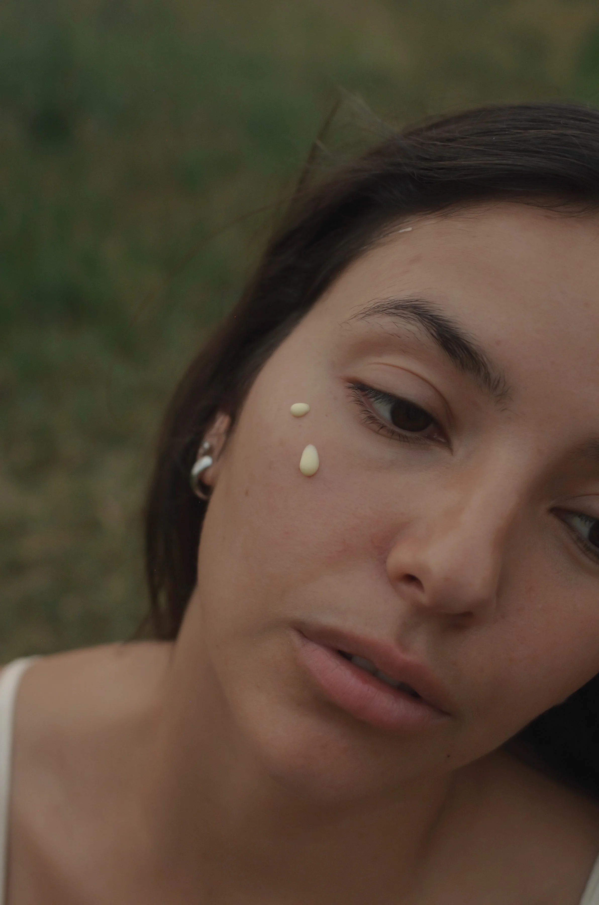 Acne Perscription.JPG