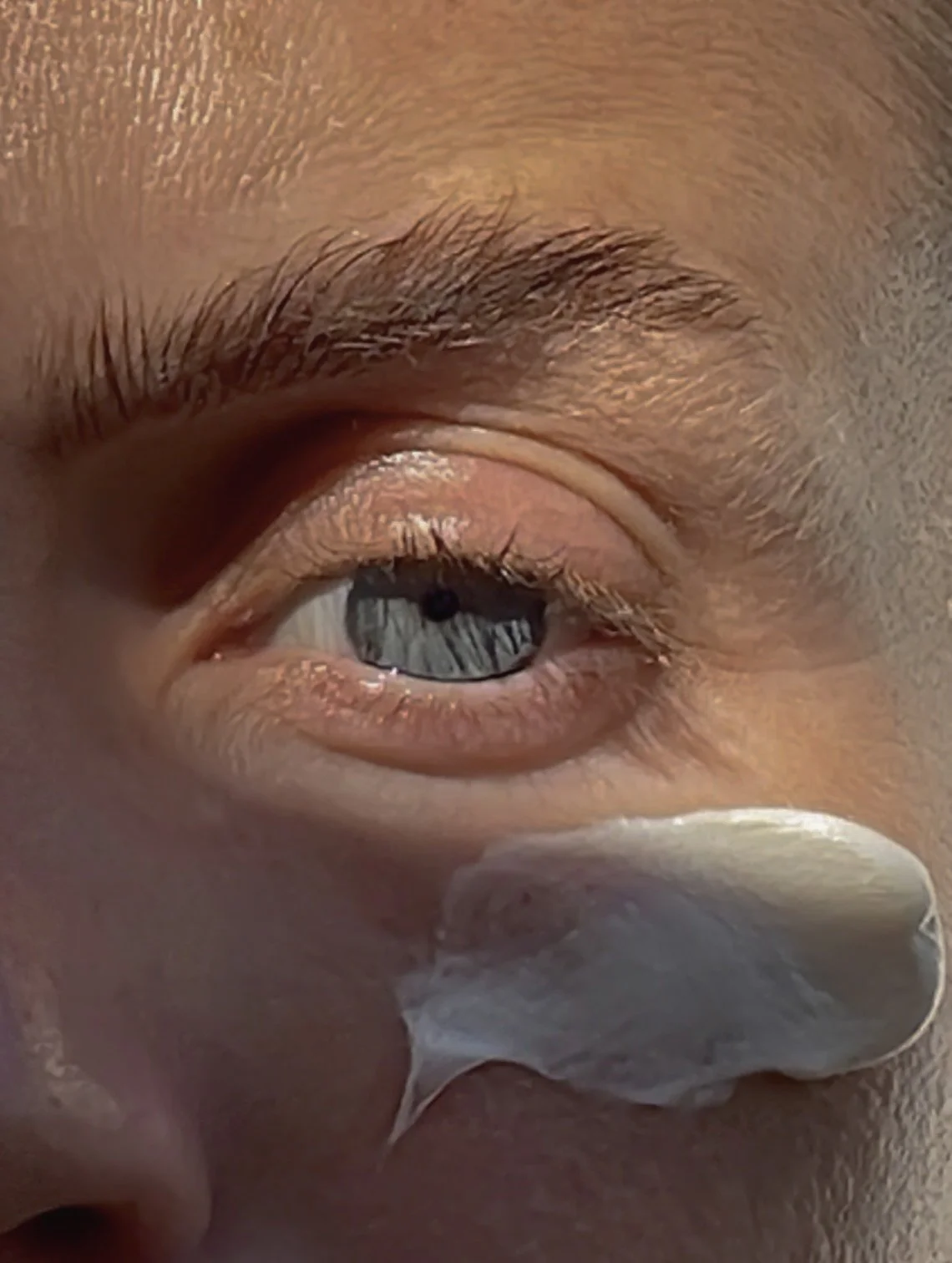 Detailed view of under-eye skin with skincare cream, helping in understanding your skin barrier health.
