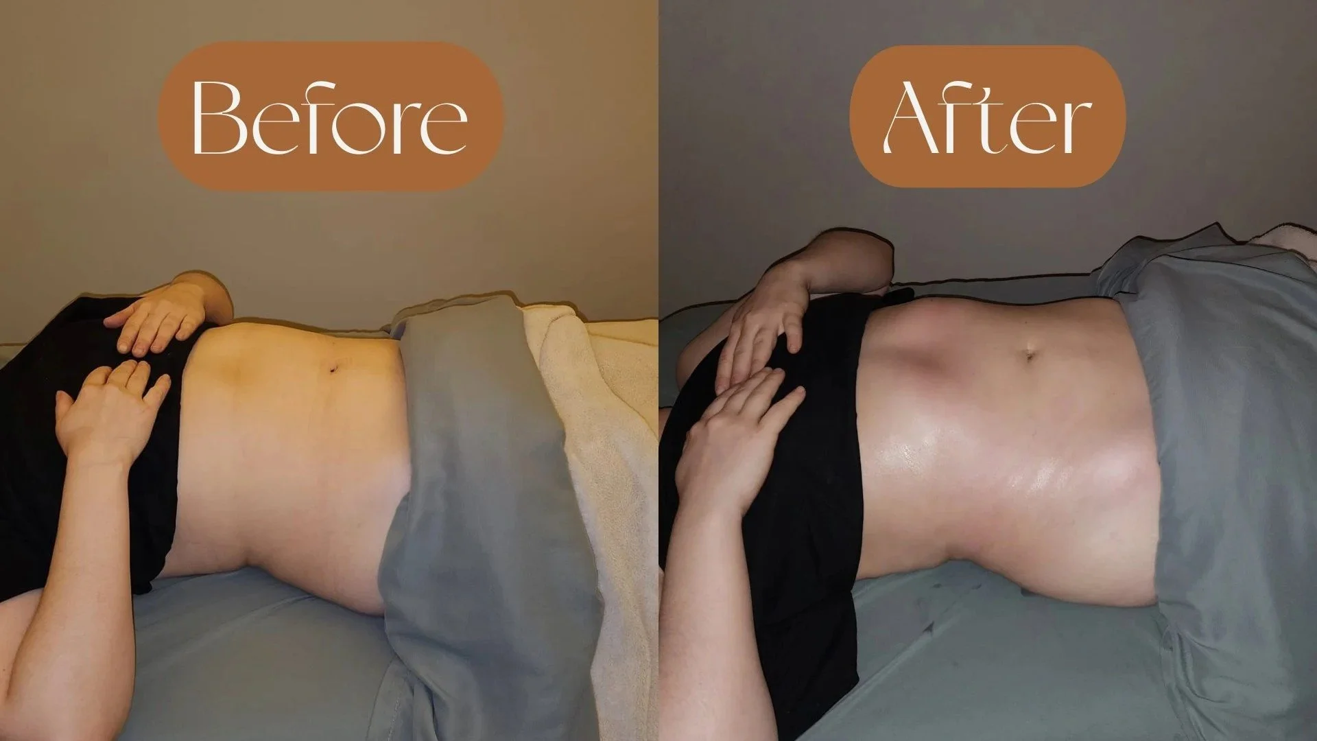 deep-tissue-massage-treatment