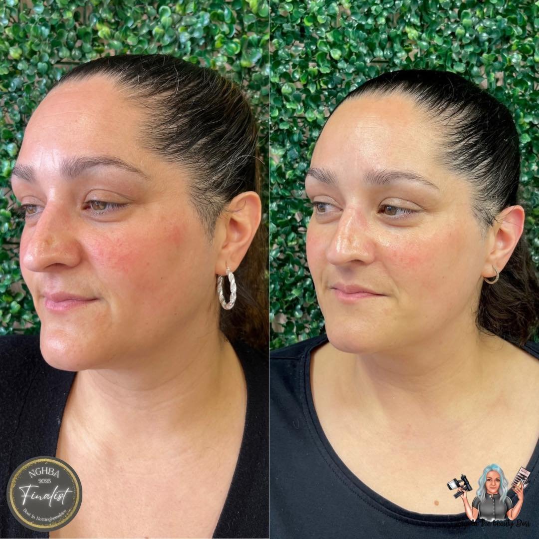 6 weeks ago this beauty came for a facial and then took the skin care kit.

I gave her a simple 4step skin care routine to follow!

She came back today for a follow up facial and we was blown away with the results!

If you would like to know more or 