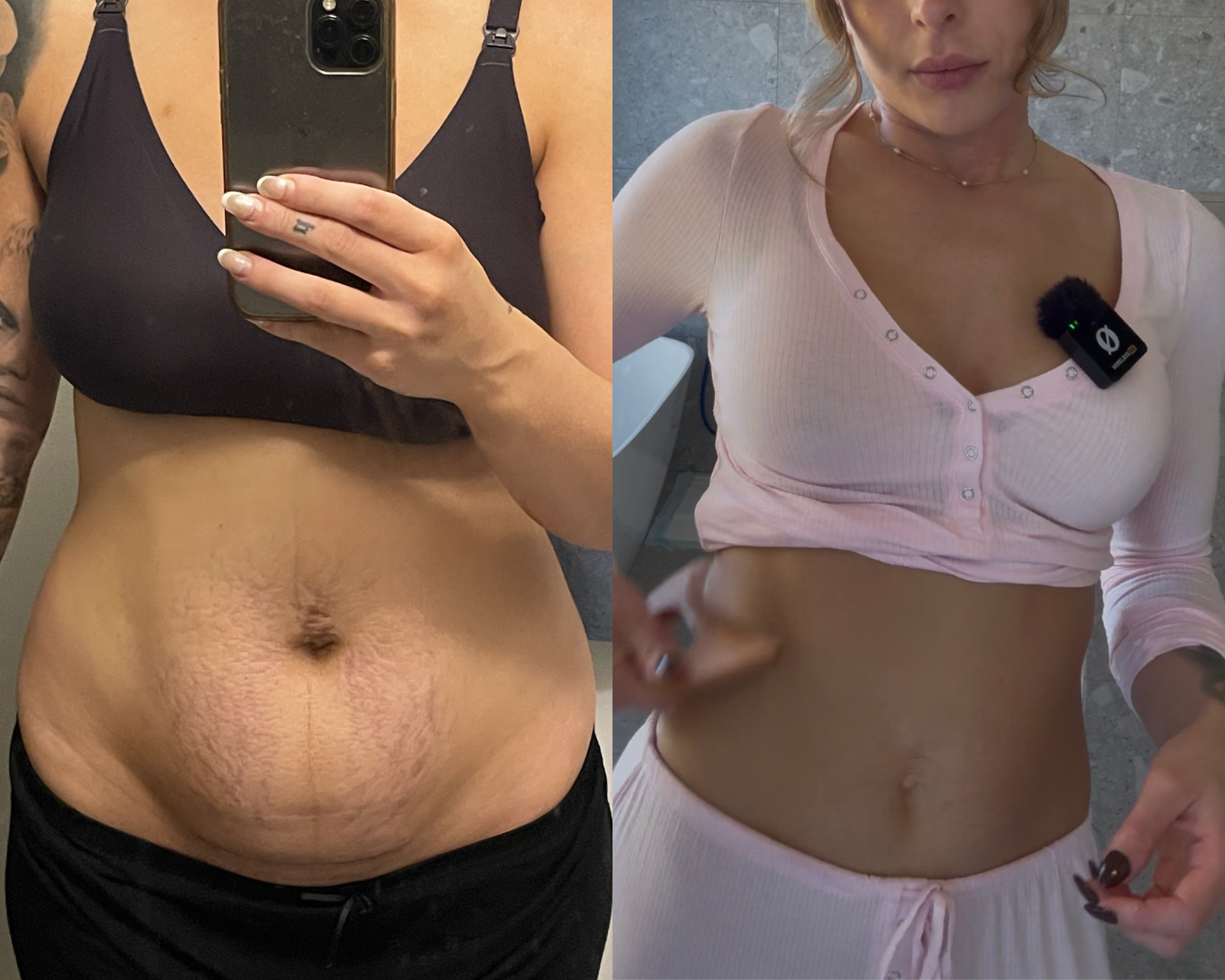 Comment j’ai transformé mon ventre après mon accouchement