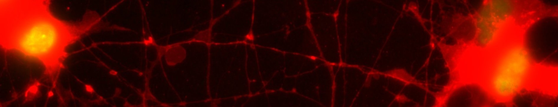 Accell_1uM_2 (Red).jpg
