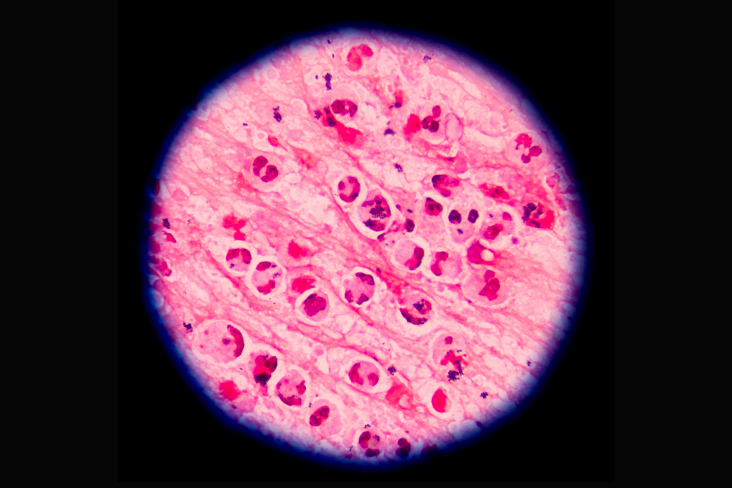 The Outbreak America Stopped Watching For: What We Still Don’t Know About Cyclospora