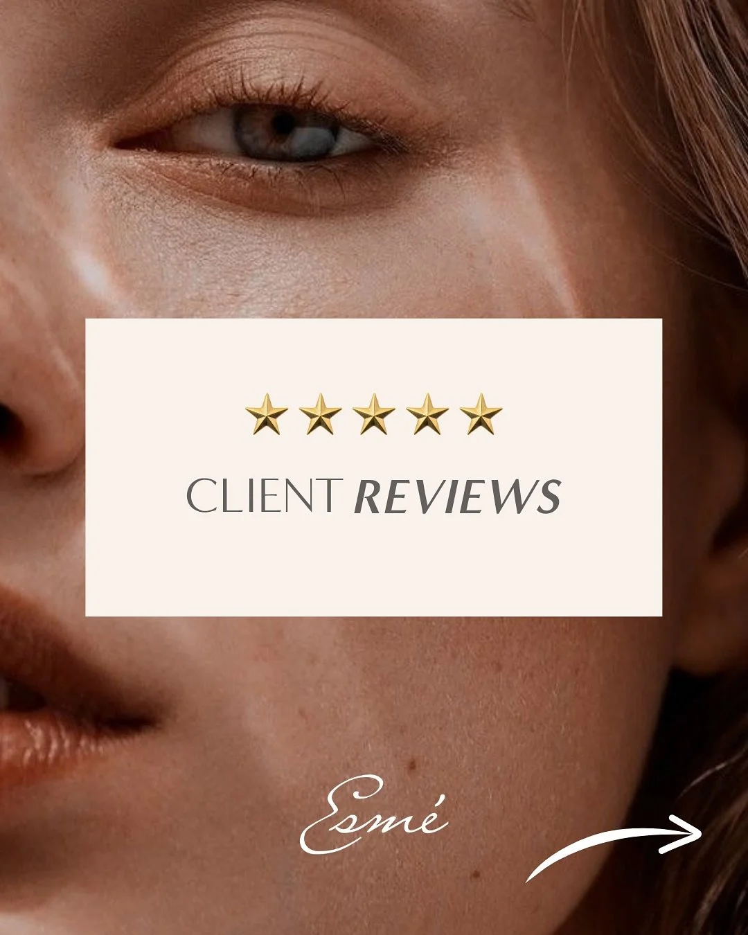 Your kind words truly brighten our day 🤍
Thank you for trusting Esm&eacute; Beauty Boutique with your beauty journey &mdash; your reviews keep us inspired, motivated, and grateful every single day.

________

(Esm&eacute; Beauty Boutique Calgary, Ca
