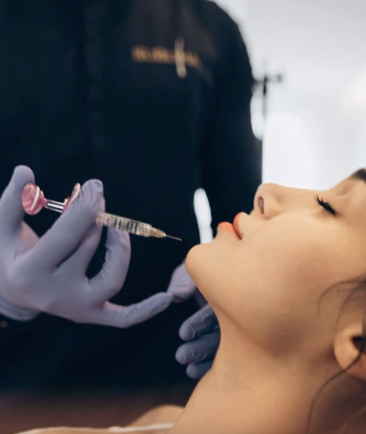 Séance d'injection de lèvres à l'acide hyaluronique au Centre Sublima Strasbourg