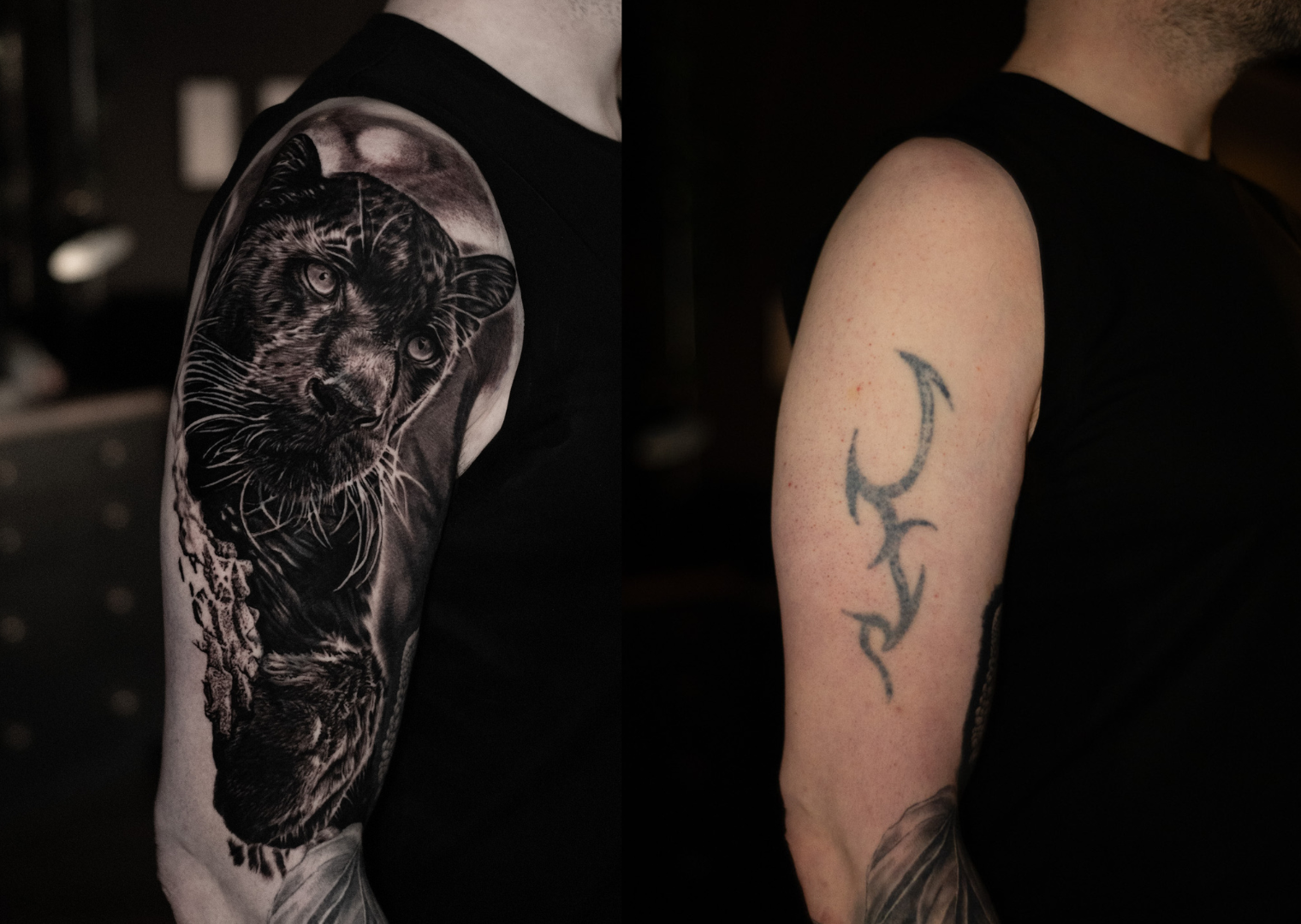 Why laser can make all the difference before a cover-up