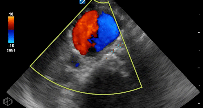 "Yin-yang" within a large AAA