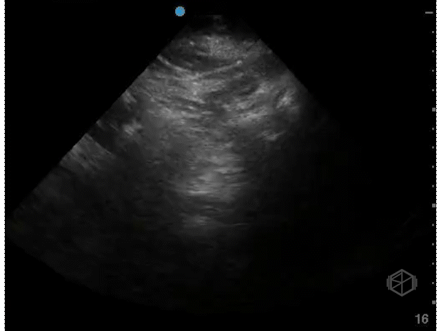 Bladder Transverse (Female)