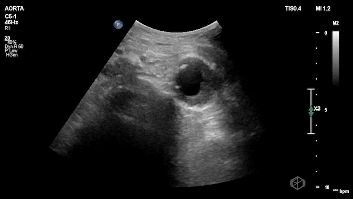 September SonoProps