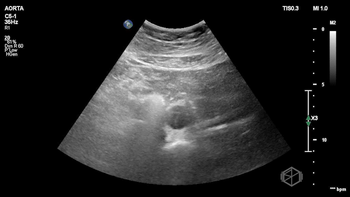 January 2026 SonoProps