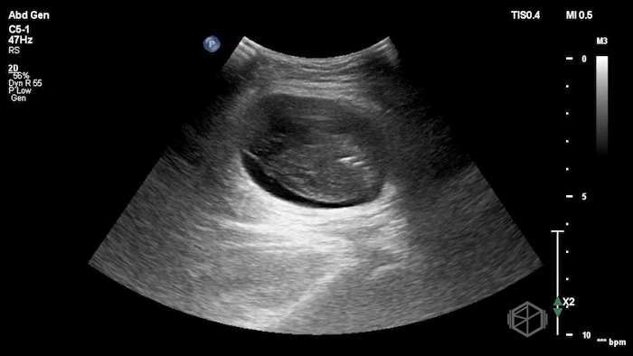 May SonoProps