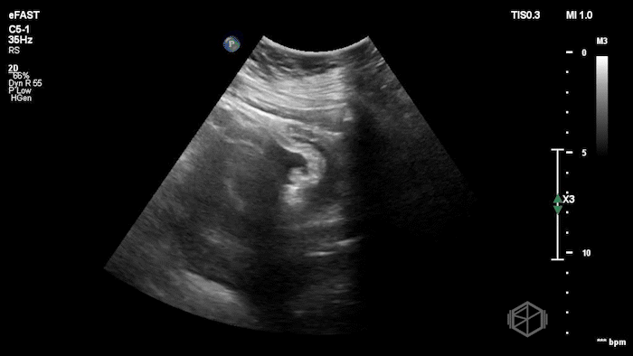 July SonoProps