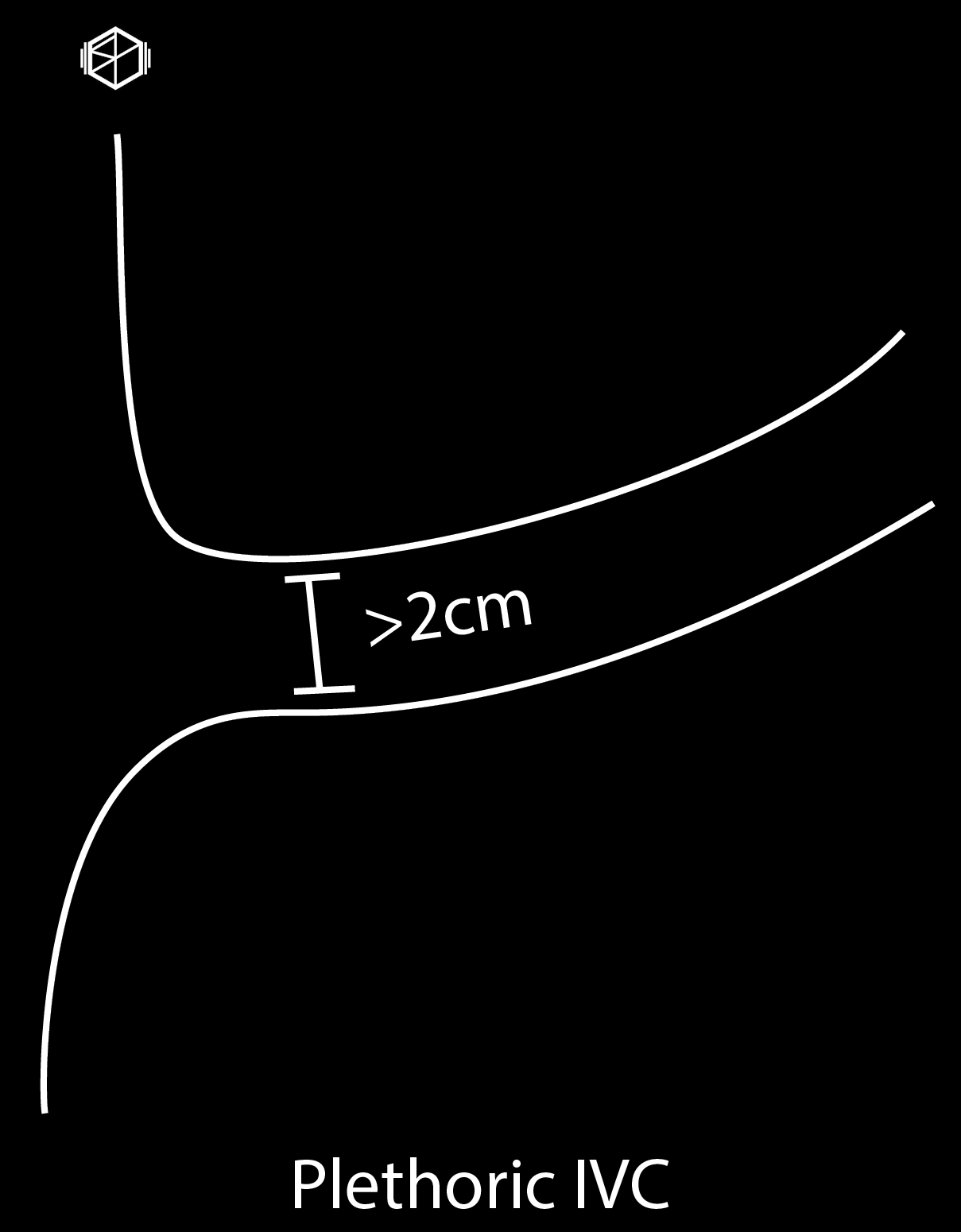 TamponadePlethoricIVC-01_10.png