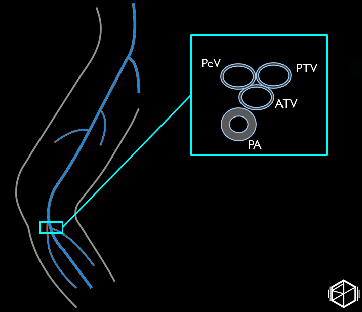 Leg Trifurcation, Sketch Anatomy
