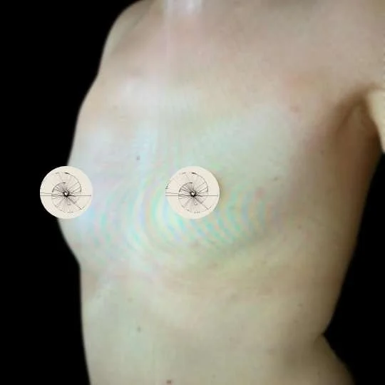breast augmentation before and after​ by Miss Jurga Pikturnaite, female plastic surgeon.