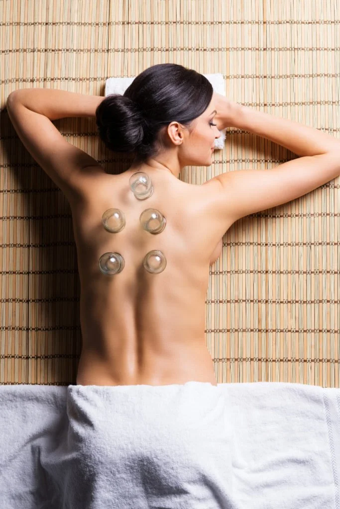 cupping.jpg