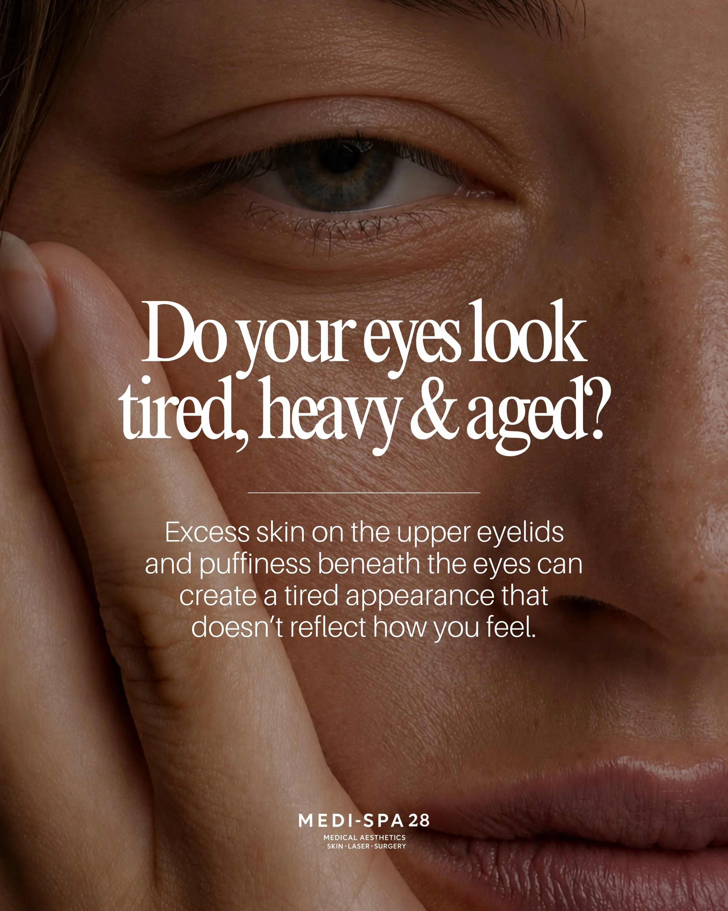 Heavy eyelids, excess skin, and under-eye bags can make you look tired, even when you&rsquo;re not. 👁️

Swipe through to discover how blepharoplasty can help restore a brighter, more refreshed appearance.

Professor Irfan Jeeva, globally renowned oc