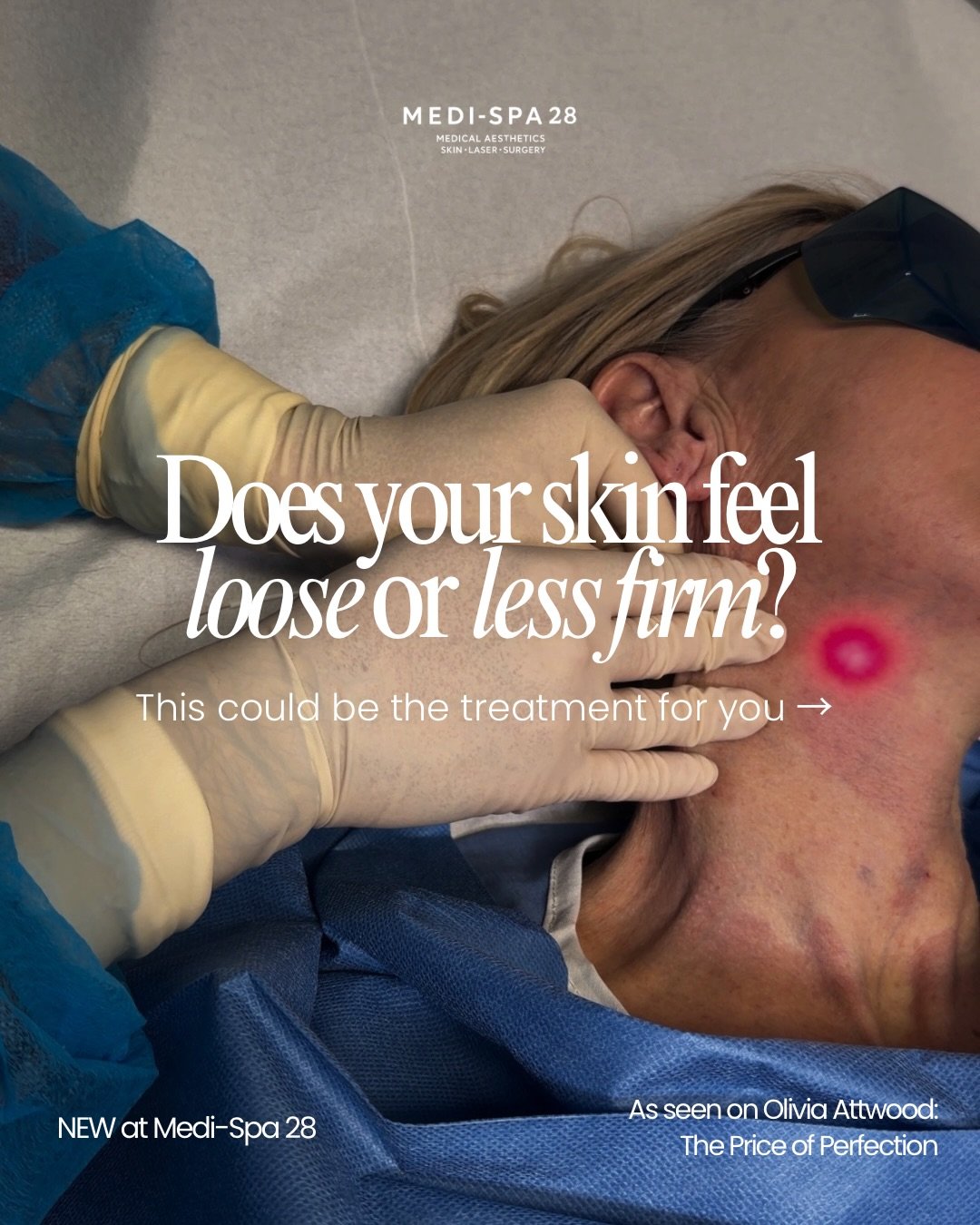 As seen on Olivia Attwood: The Price of Perfection on @itvxofficial - EndoLaser is a minimally invasive treatment designed to tighten, firm and contour from within.

Using advanced energy technology beneath the skin, EndoLaser helps stimulate collage
