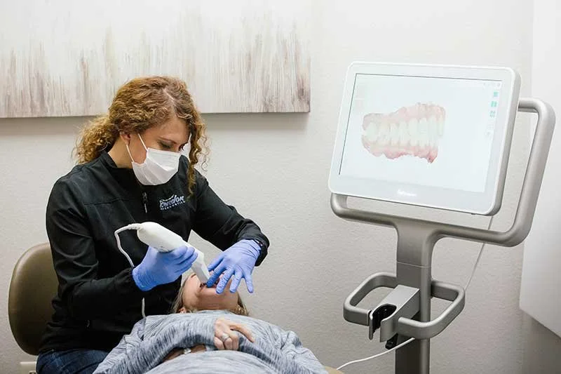 Digital Mouth Scanning- ITERO Naples FL