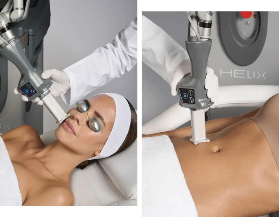 A woman receiving a facial treatment with a large medical device, while lying on a medical bed. The woman has eye protection and a headband. The treatment appears to be on her face and abdomen.