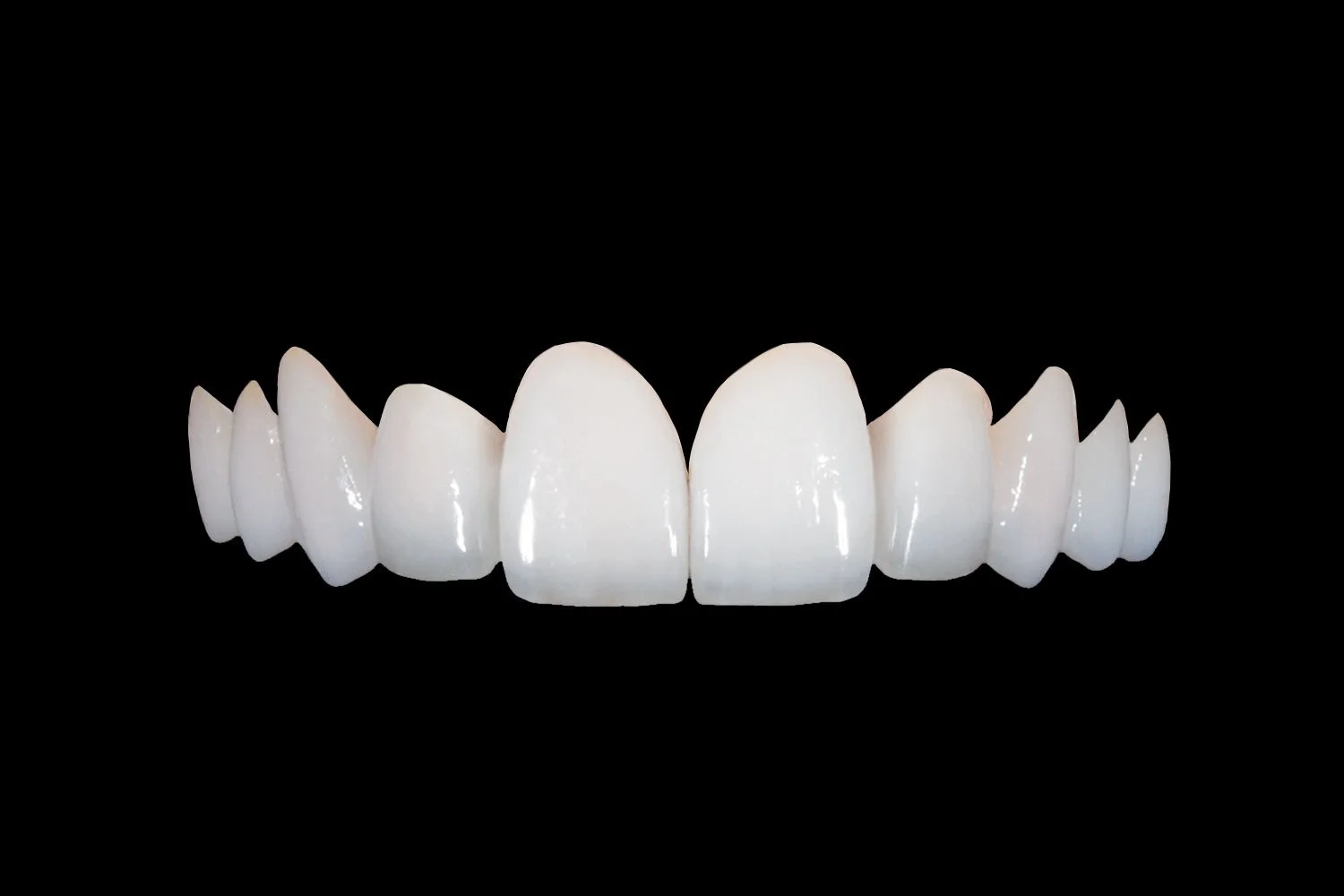 Product_Feldspathic-Veneers.jpg