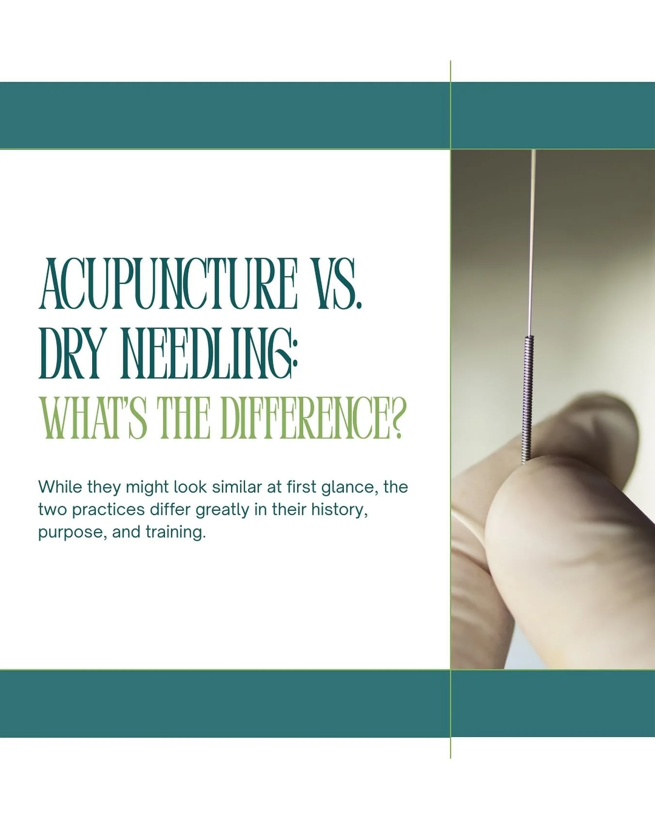 I have to admit: when I get asked if I do dry needling, I have to laugh. Dry needling is what acupuncture is called when it&rsquo;s done by someone who&rsquo;s not an acupuncturist (usually a physical therapist or a chiropractor). 

And while acupunc