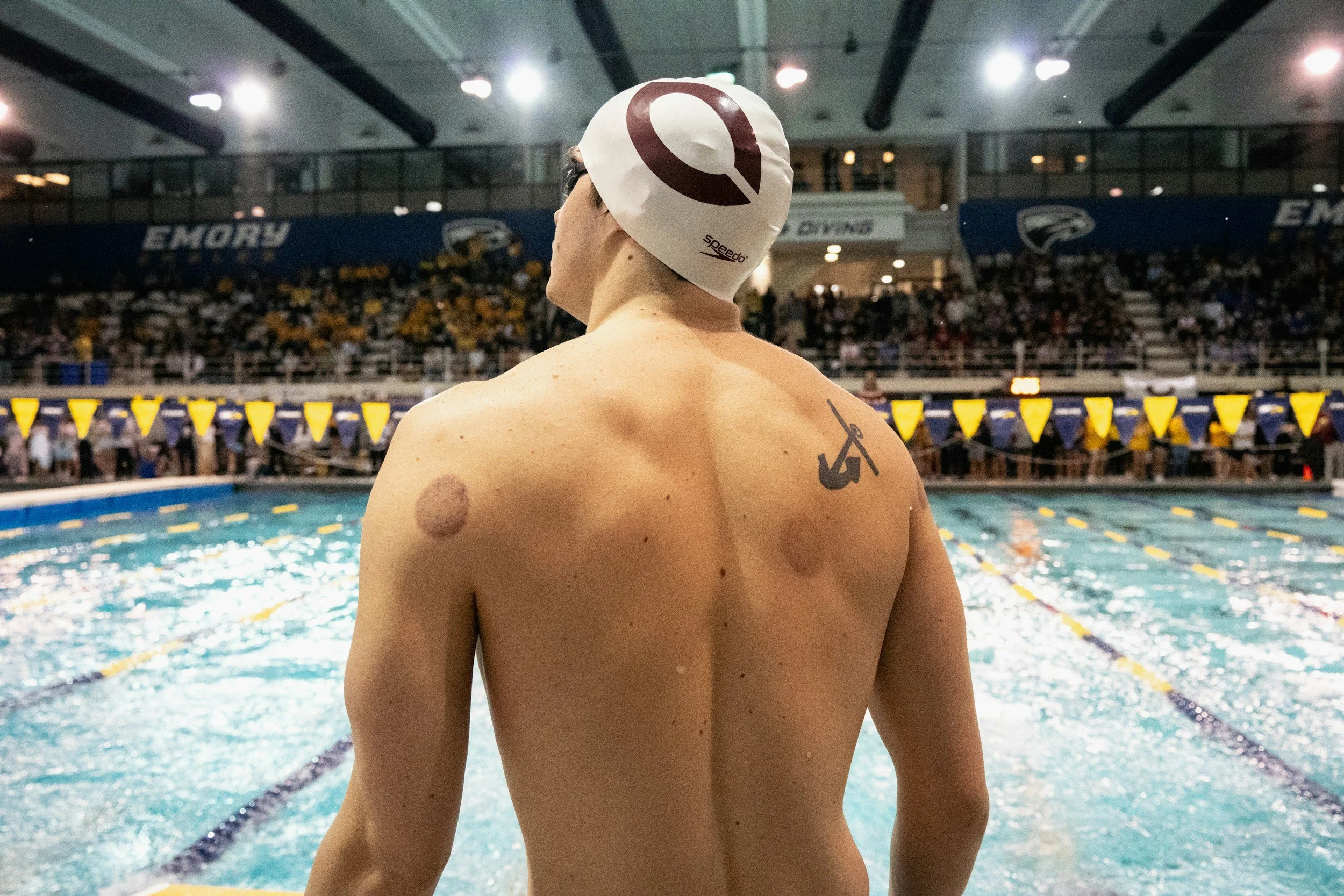 Cup marks on olympic athlete