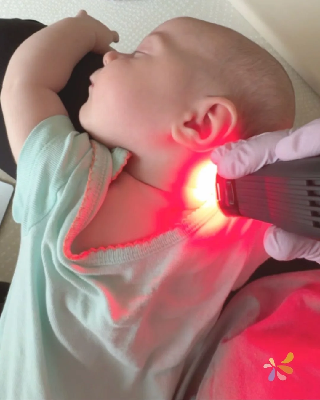  Philadelphia Neuroadaptive Intensive Laser Therapy; Infant Tongue Tie 