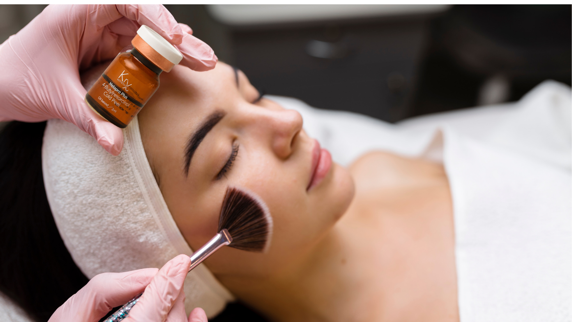 Your Guide to Chemical Peels: A Fresh Start for Your Skin