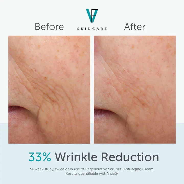 serum_cream_results_smile_line_wrinkles.webp