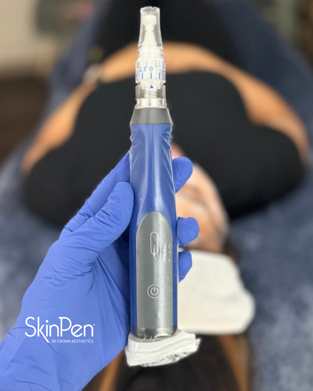 Miksi syksy on hyvä aika SkinPen®-mikroneulaukselle?