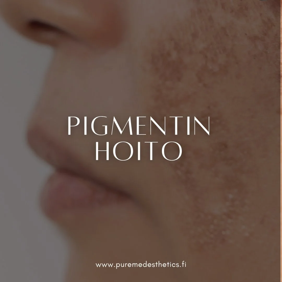 IPL-hoito on yksi tehokkaimmista keinoista pigmenttimuutosten, kuten auringon aiheuttamien pigmenttil&auml;iskien ja ep&auml;tasaisen ihons&auml;vyn hoidossa. 

Hoidossa valoenergia kohdistuu ihon ylim&auml;&auml;r&auml;iseen pigmenttiin eli melaniin