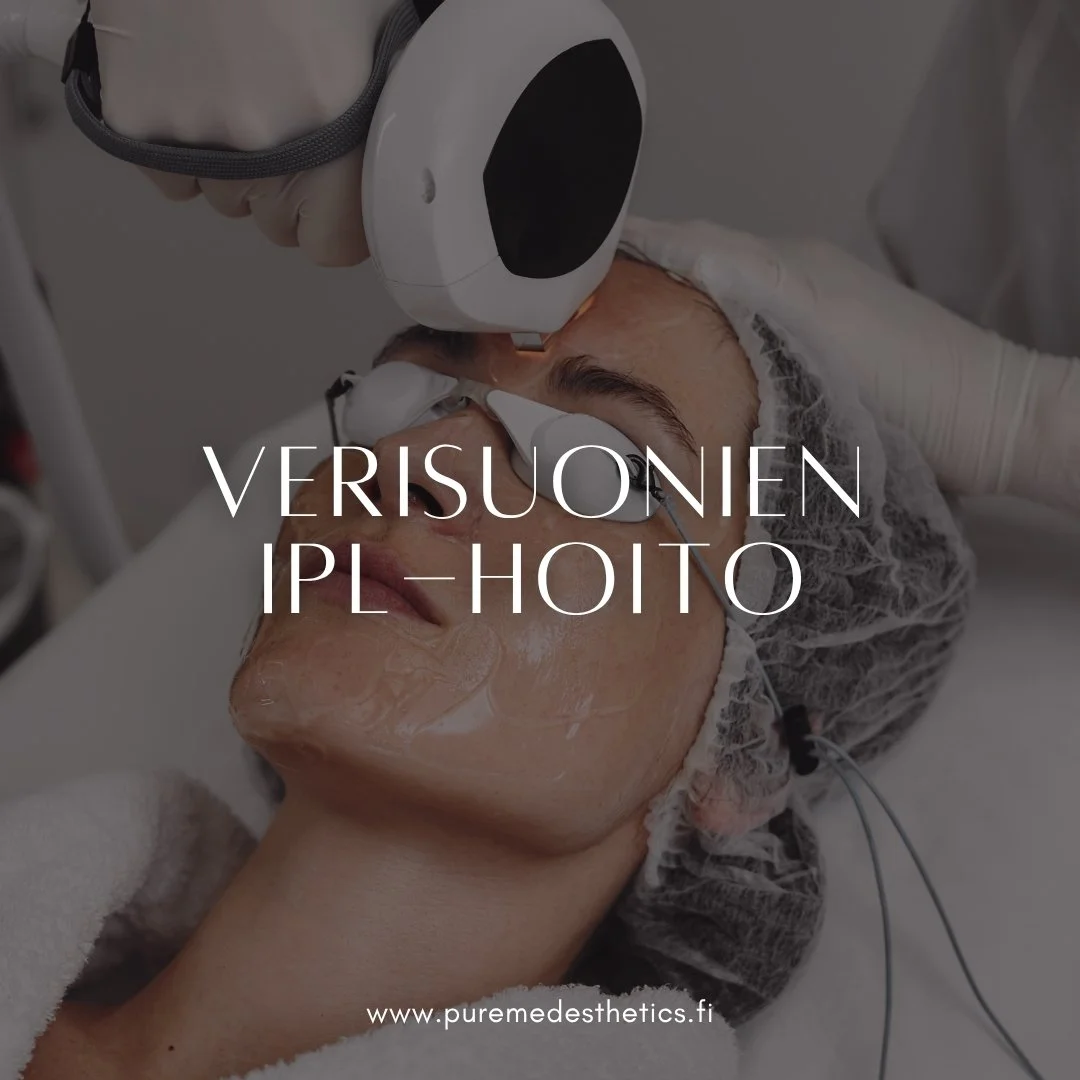 IPL-hoidolla voidaan v&auml;hent&auml;&auml; ihon pinnalla n&auml;kyvi&auml; pieni&auml; punaisia verisuonia sek&auml; laaja-alaista kasvojen punoitusta. 
Hoito sopii esimerkiksi couperosaan, rosaceaan eli ruusufinniin liittyv&auml;&auml;n punakkuute