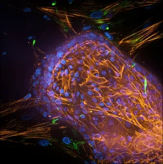 The Fugure of Biotech: Organoids