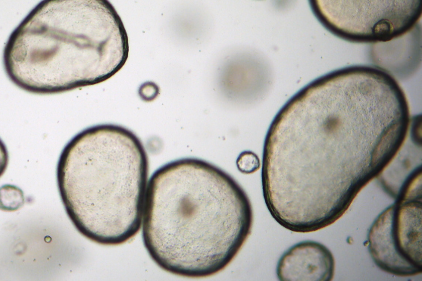 White Paper: Redefining Fibroid Research with Human-Derived Cell Models