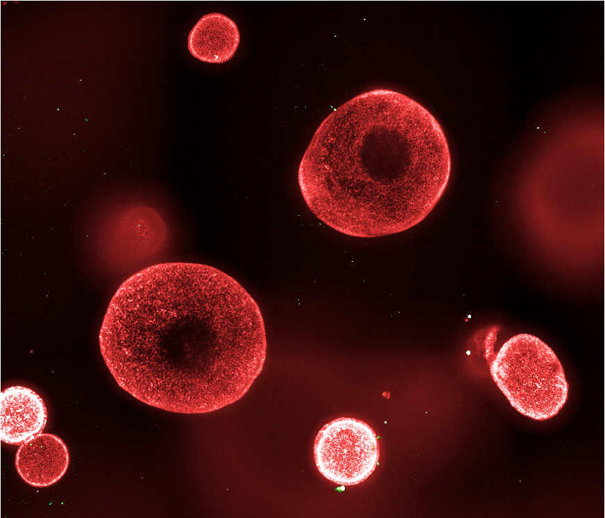 Application Note: Human Endometrial Organoids as a New Approach Methodology (NAM) for Preclinical Cytotoxicity Testing in Women’s Reproductive Health