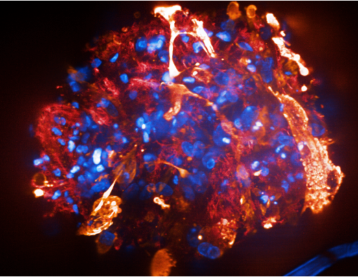 Future of Biotech: Organoids