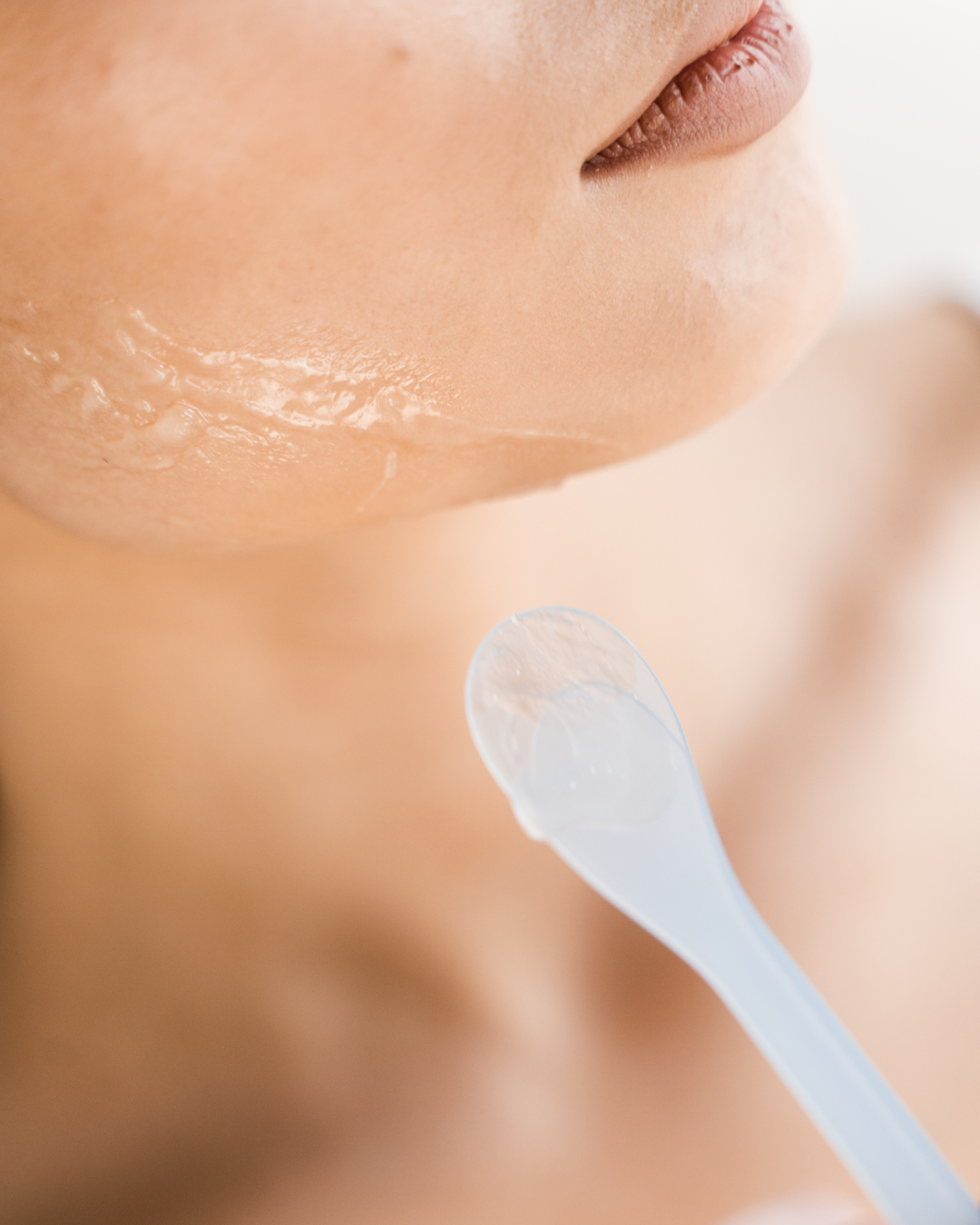 Carboxy Therapy in Naperville, IL | Levore Aesthetics