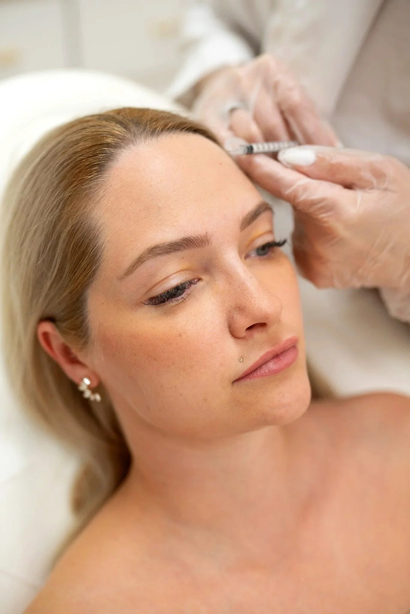 Discover Best Botox in Naperville, IL | Levore Aesthetics