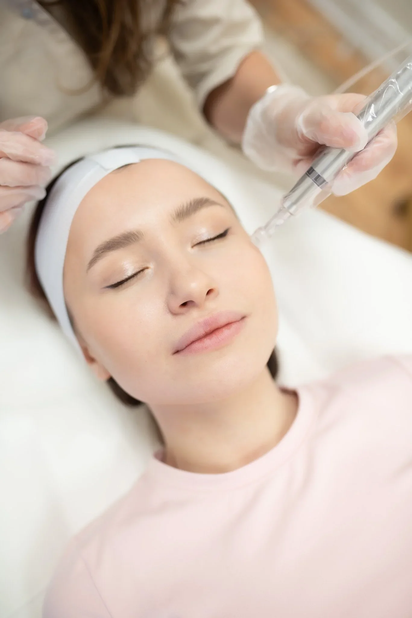 Does Microneedling Help Acne? What Most People in Naperville Get Wrong (2026 Guide)