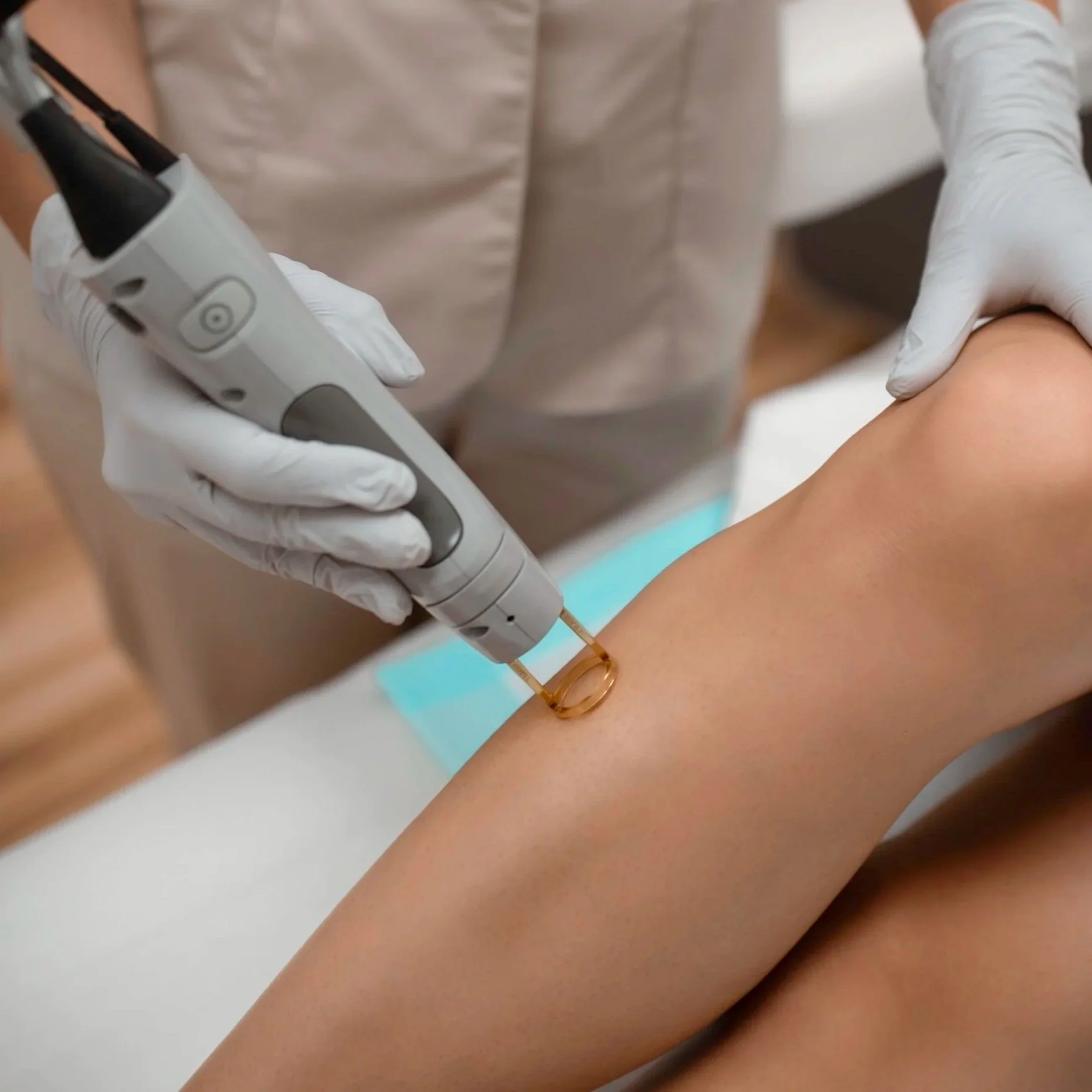 Discover Laser Hair Removal with Expert Care by Levore Aesthetics in Naperville, IL