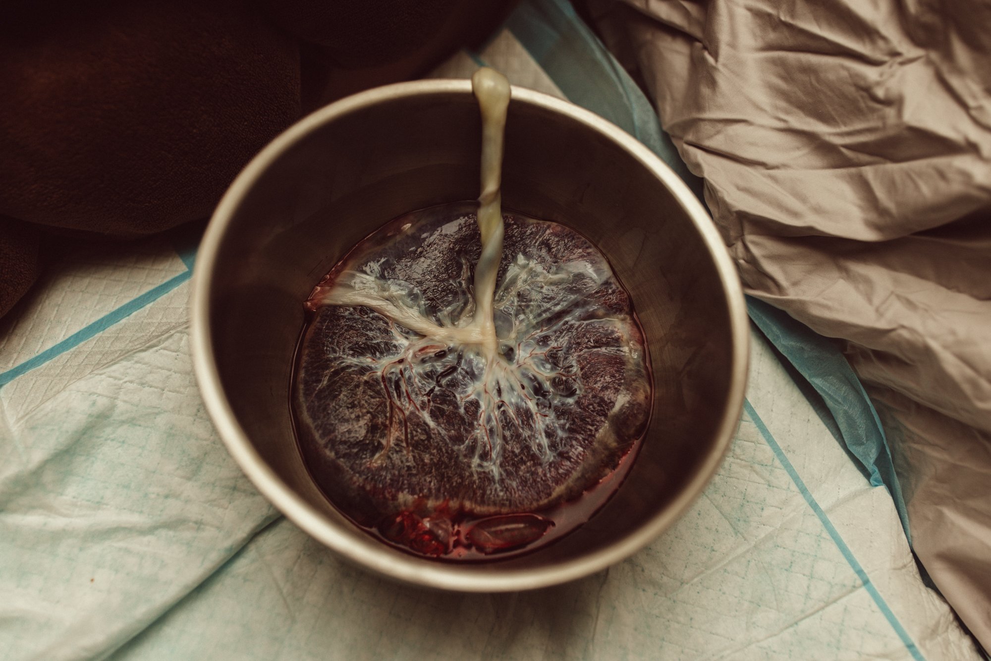 51
