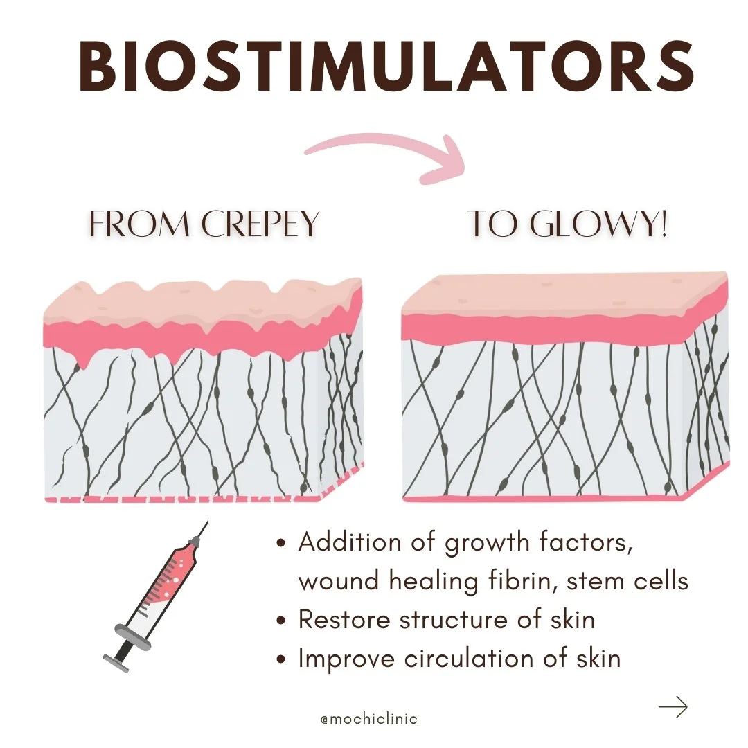 What are biostimulators?